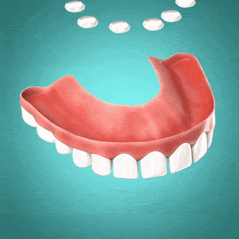 SmileCushion - Temporäre weiche Prothesenunterfütterung