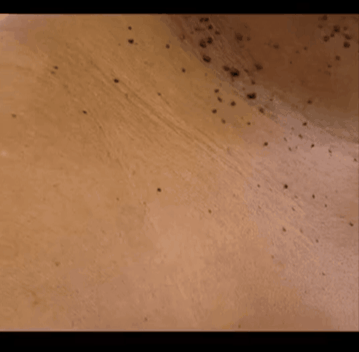 SpotDrop - Flüssigspray zur Entfernung von Hautanhängseln und Warzen