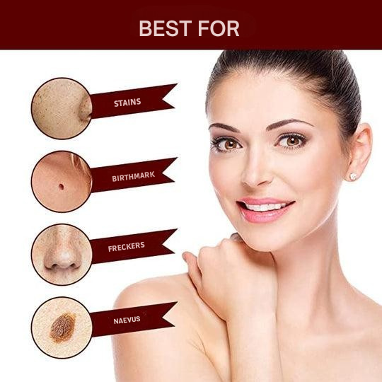 Dermapoint - Gezielter Stift zur Entfernung von Hautanhängseln