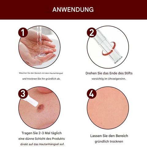 Dermapoint - Gezielter Stift zur Entfernung von Hautanhängseln
