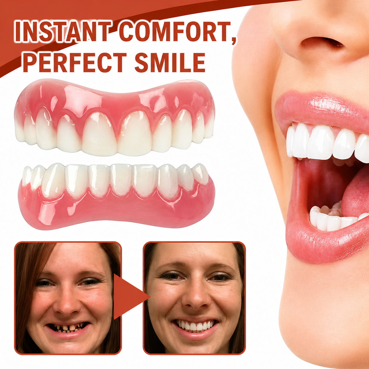SmileCushion - Temporäre weiche Prothesenunterfütterung