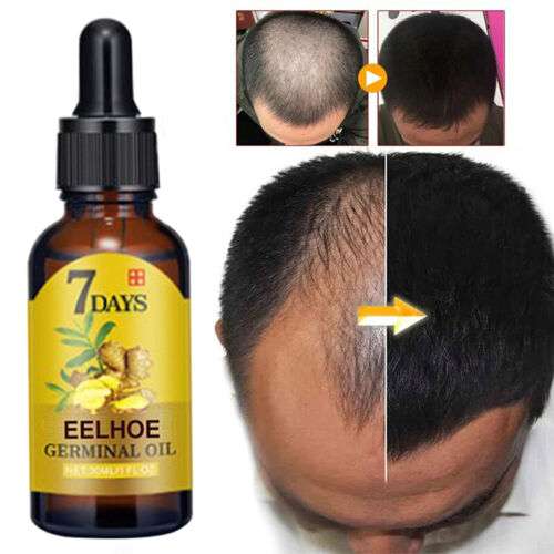 RootRevive - Gezieltes Haarserum für die Kopfhautpflege