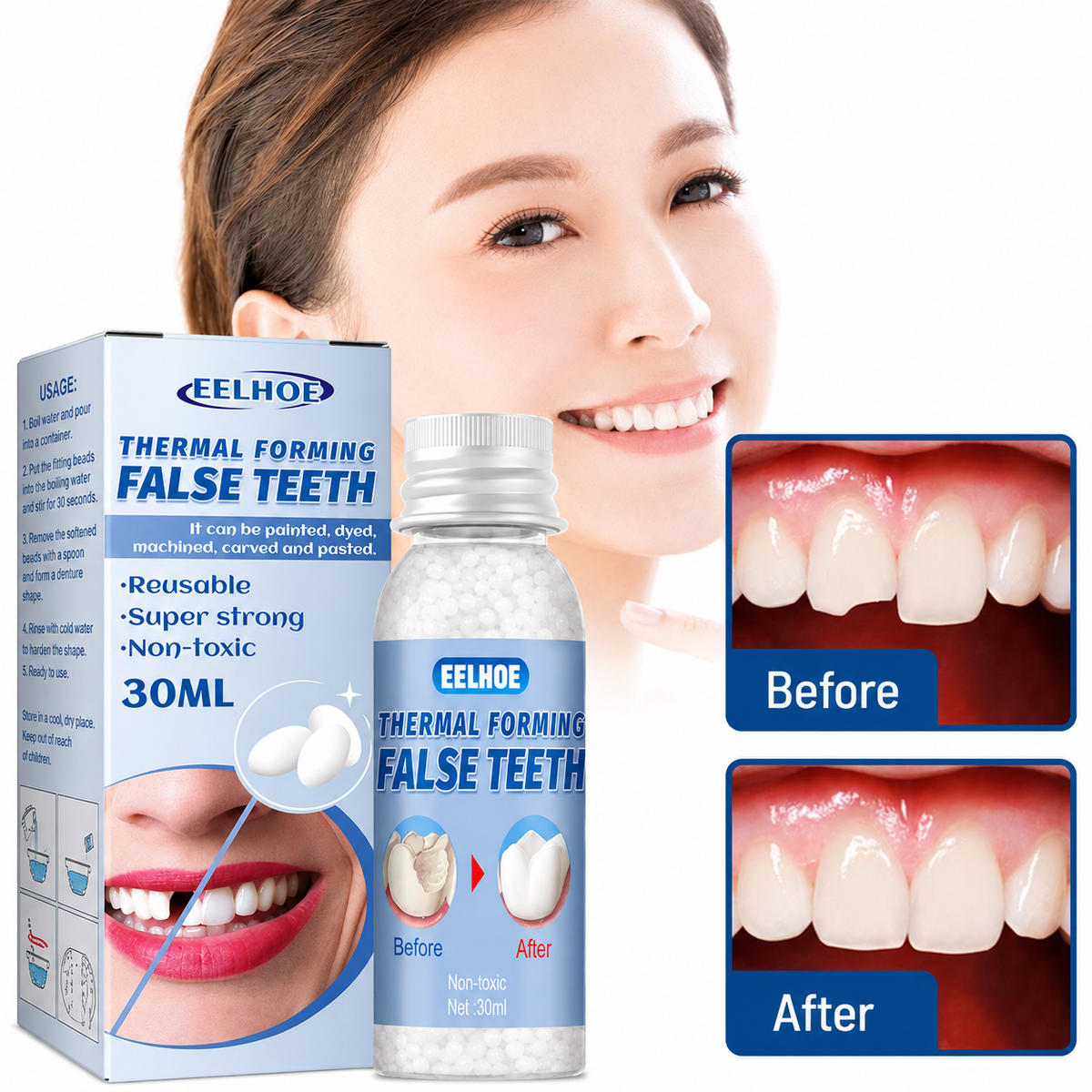 TempSmile - Temporäres Zahnreparaturset zum thermischen Formen