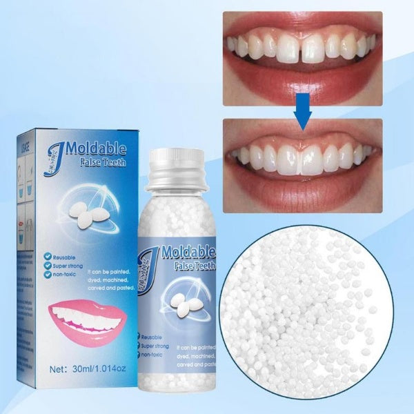 SmileFill - Formbares Set zur vorübergehenden Zahnreparatur