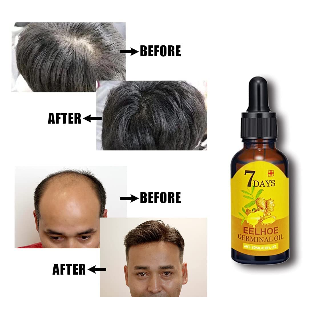 RootRevive - Gezieltes Haarserum für die Kopfhautpflege
