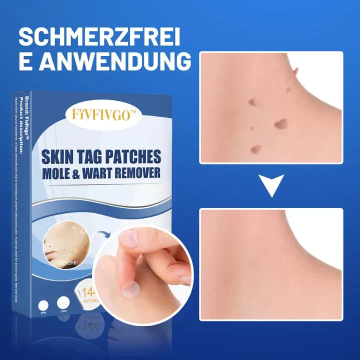 Blemisoothe - Gezielte Warzenentferner-Pflaster