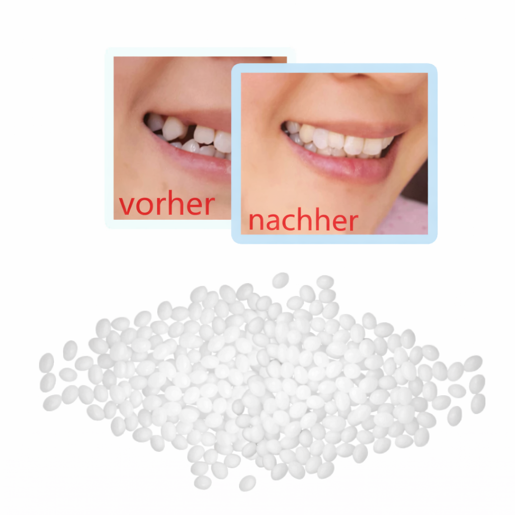 SmileFill - Formbares Set zur vorübergehenden Zahnreparatur