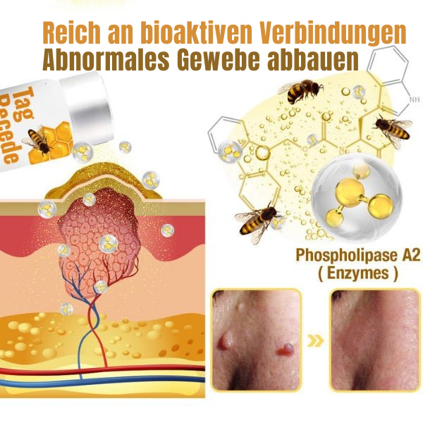 DermClear - Flüssiges Spray zur Entfernung von Hautanhängseln
