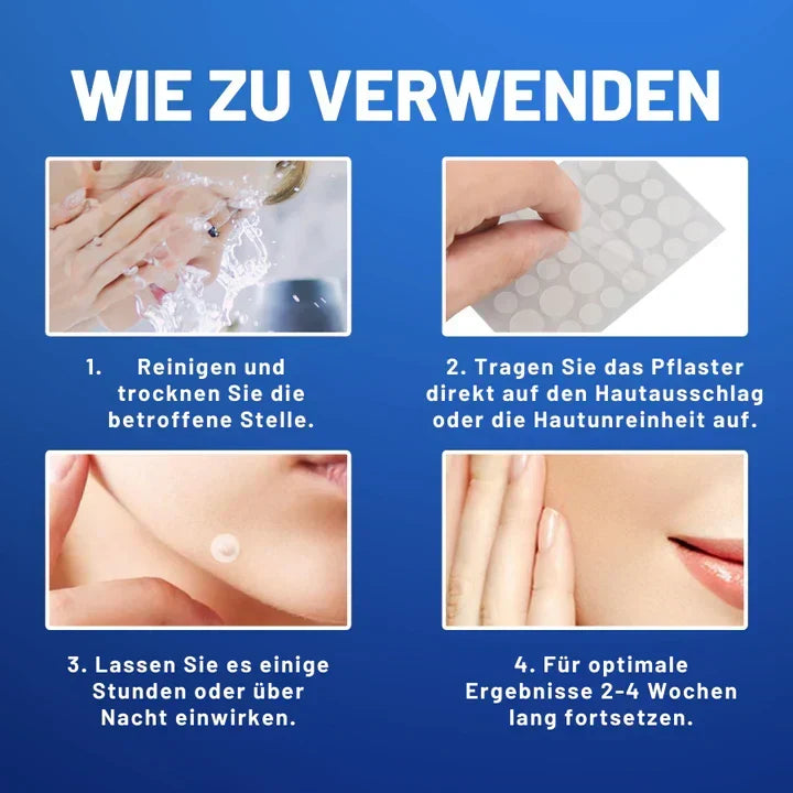 Blemisoothe - Gezielte Warzenentferner-Pflaster