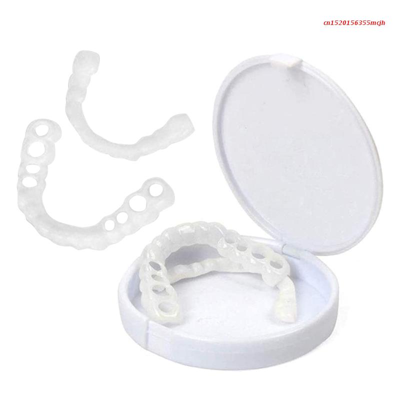 Dentasnap - Kosmetische Schnapp-Veneers