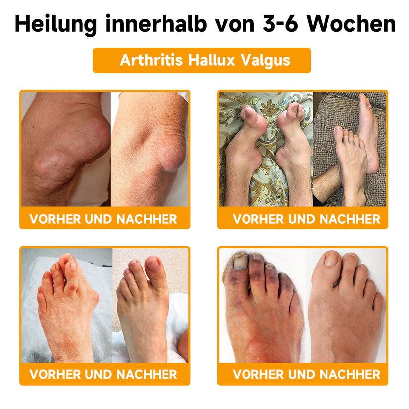 Apixia - Schnell einziehende beruhigende Creme
