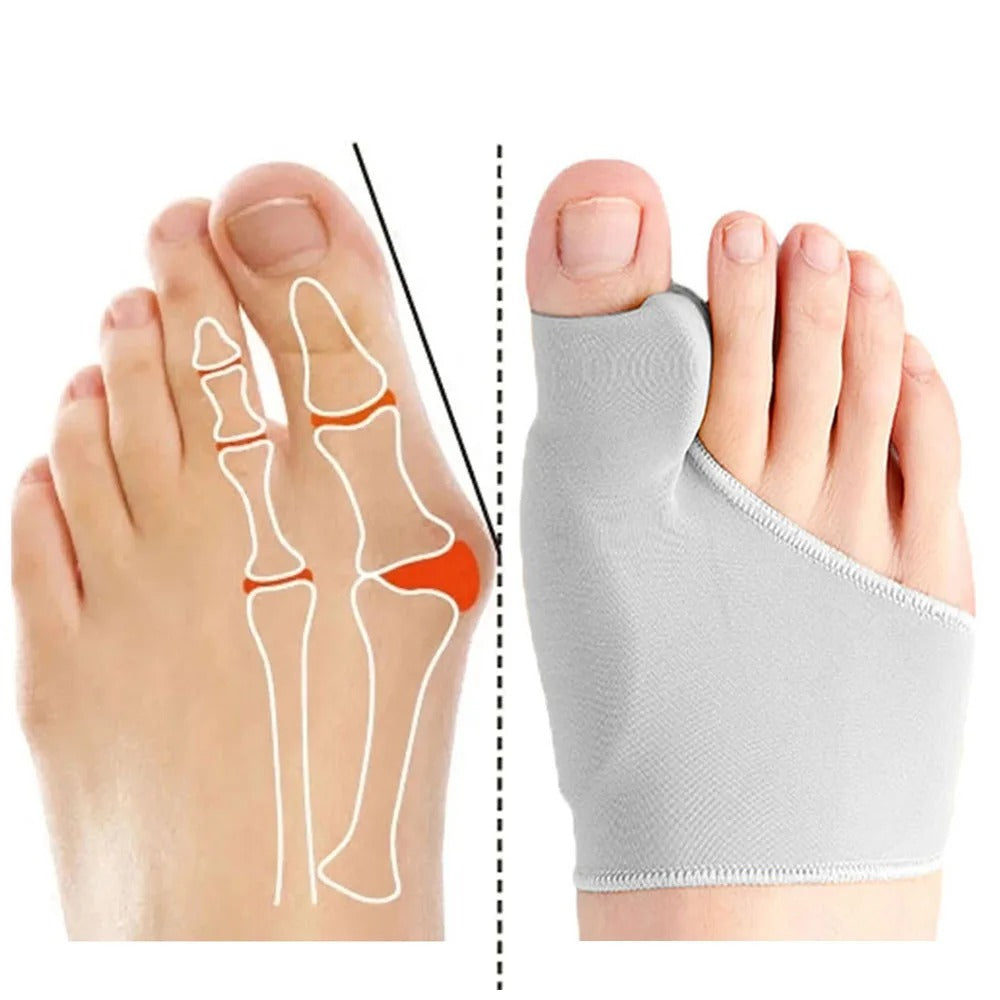 Alignica - Flexible Korrekturbandage bei Hallux valgus