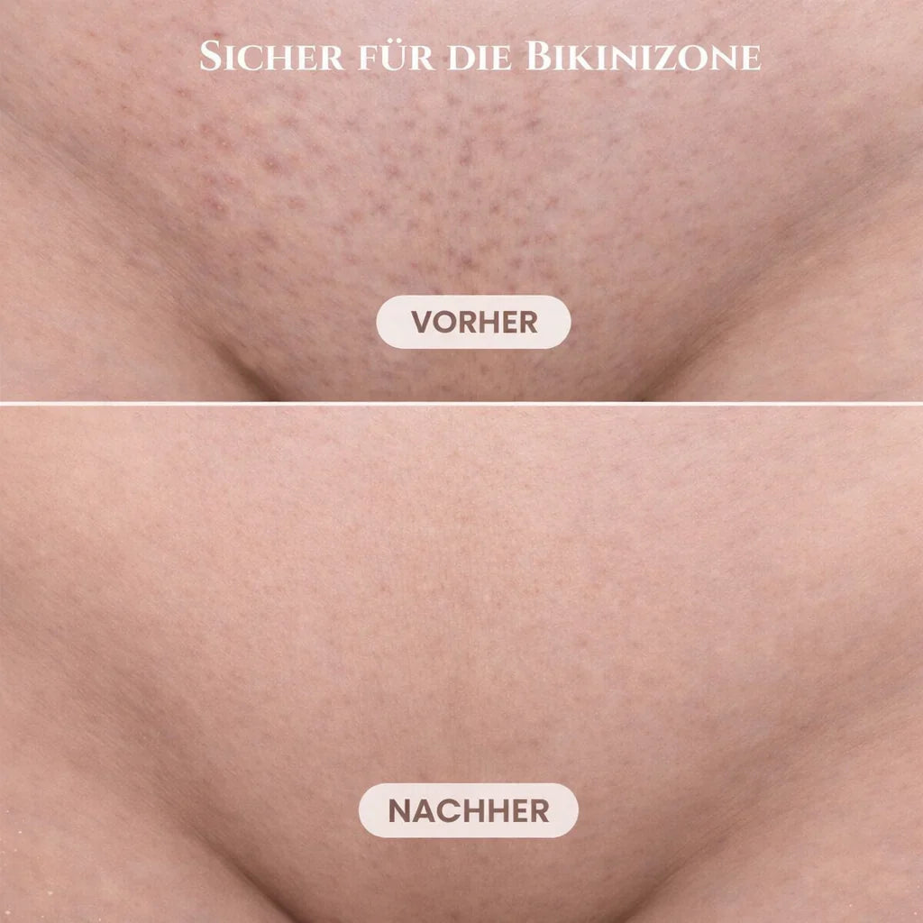 Cordless Electric Shaver For Women