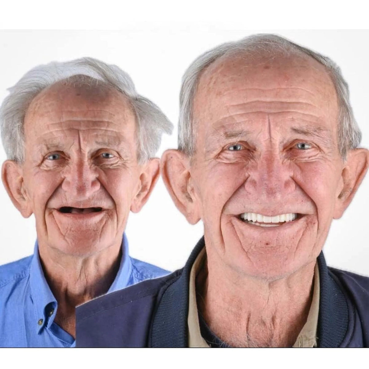 Removable Full Arch Denture Set with Flexible Cushion Grip