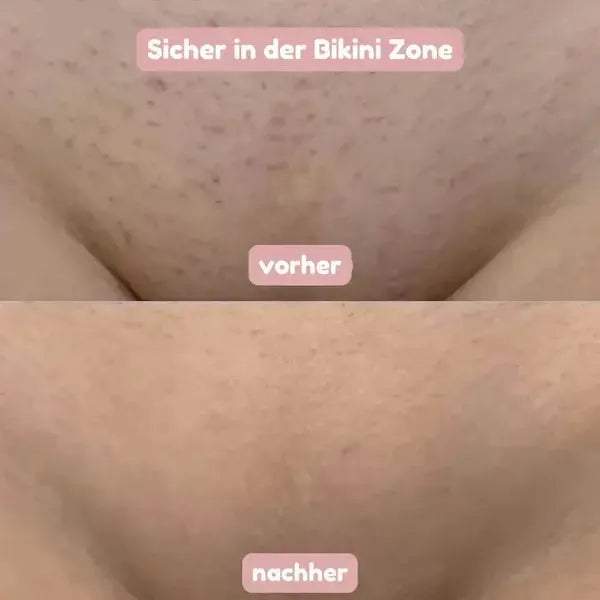 Women's 2-in-1 Gentle Shaver for Smooth Skin